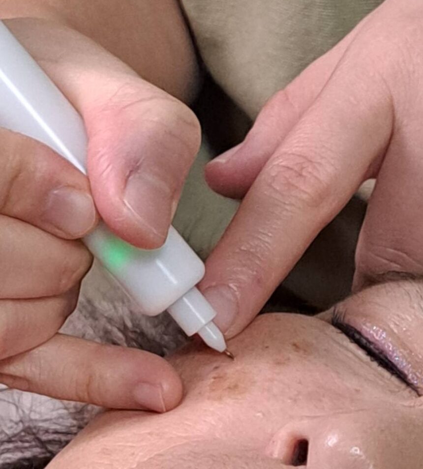 · 京橋/シミケア/СеМЬЯ (シミヤ)